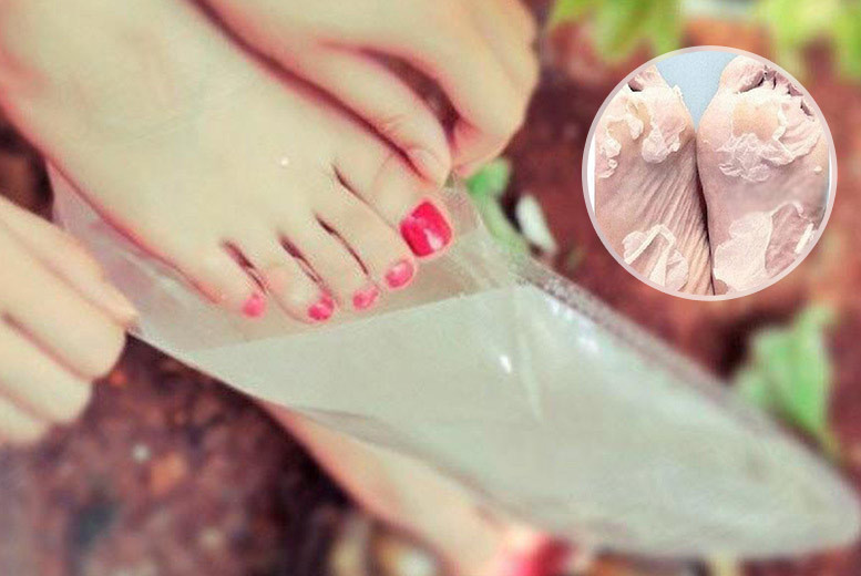 €2.99 instead of €13.98 (from Forever Cosmetics) for a pair of exfoliating foot masks, €5.99 for three pairs or €7.99 for five pairs - save up to 79%